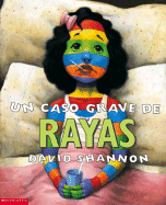 Un caso grave de rayas (Spanish Edition)