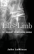 Life is Greater Than Limb