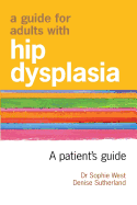 A Guide for Adults with Hip Dysplasia