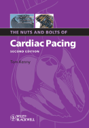 The Nuts and Bolts of Cardiac Pacing 2nd Edition by Kenny, Tom (2008) Paperback