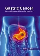 Gastric Cancer: Current Status and Future Perspectives