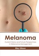 Melanoma: Current Status and Future Perspectives in Melanoma Management