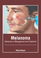 Melanoma: Advances in Management and Treatment