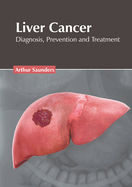 Liver Cancer: Diagnosis, Prevention and Treatment