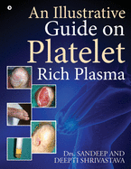 An Illustrative Guide on Platelet Rich Plasma