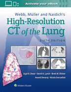 Webb, M├â┬╝ller and Naidich's High-Resolution CT of the Lung