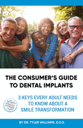 The Consumer's Guide to Dental Implants: 3 Keys Every Adult Needs to Know About A Smile Transformation