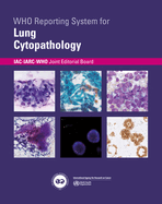 WHO Reporting System for Lung Cytopathology (WHO Reporting Systems for Cytopathology, 1)