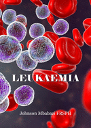 Leukaemia